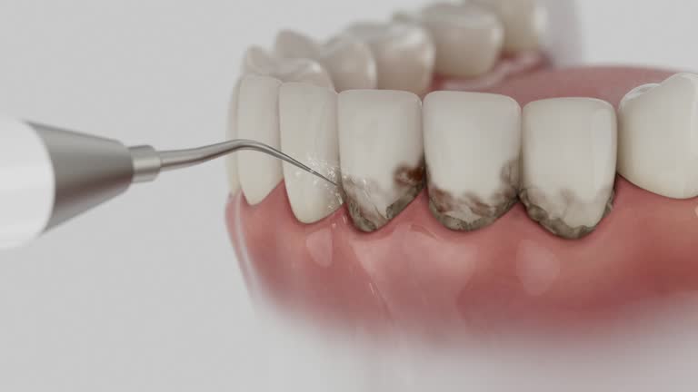 Reliable Tooth Extraction contractor in Covington, VA by Smile Center Dentistry